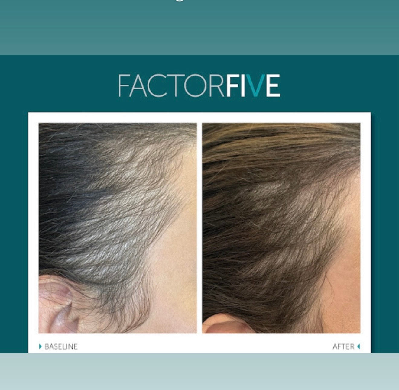 Factorfive Shampoo Advanced Haircare